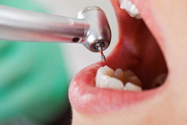 Best Dentist for Tooth Abscess  in Towaco, NJ